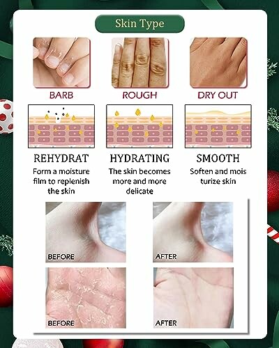 Chart showing skin types and treatments: barb, rough, dry out.